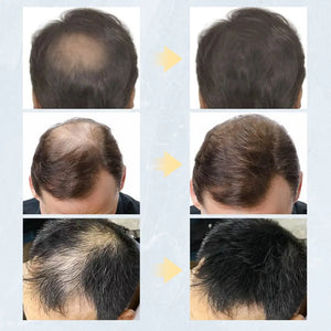 Keratin Hair Fibers