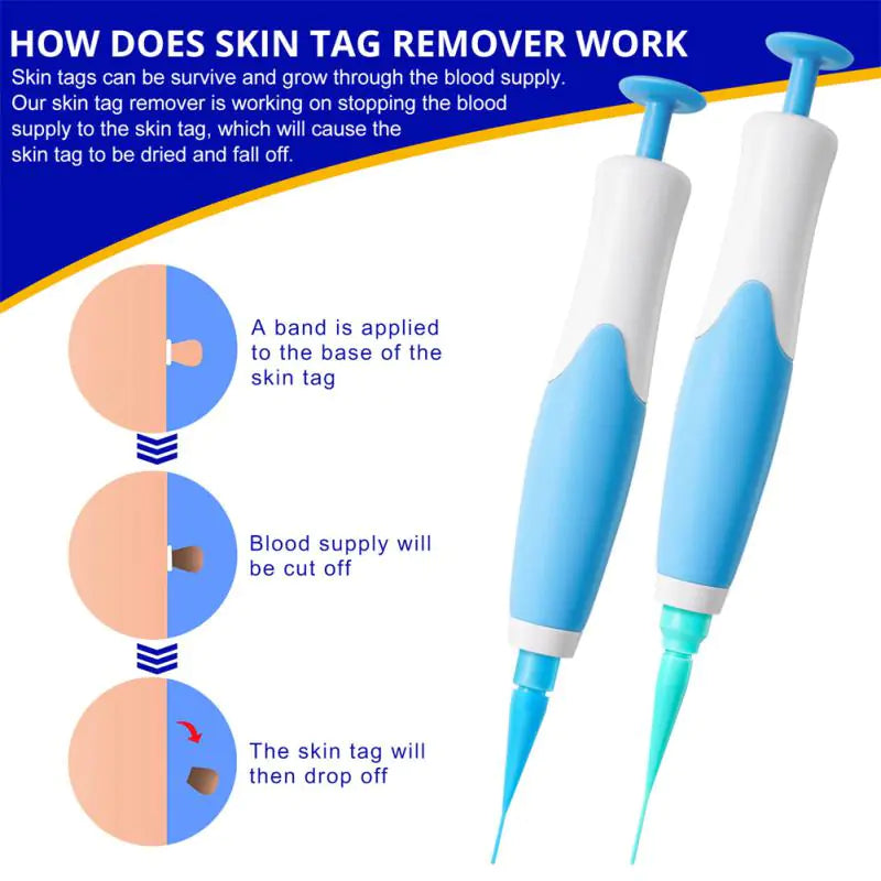 Skin Tag Remover