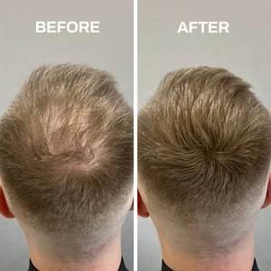 Hair Fibers Thinning Hair